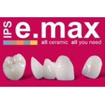 Răng sứ E.max